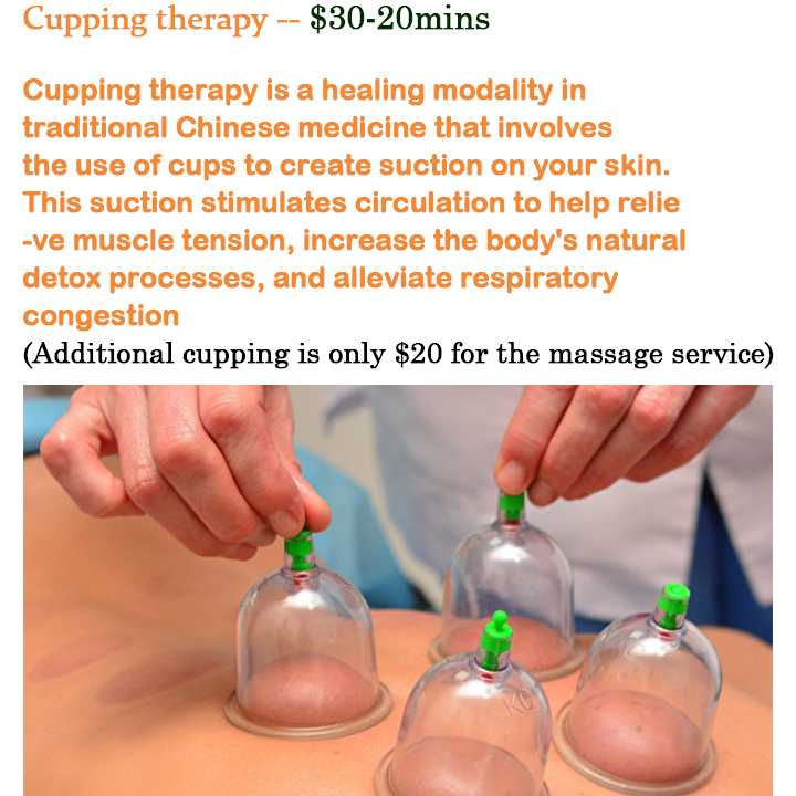 Cupping