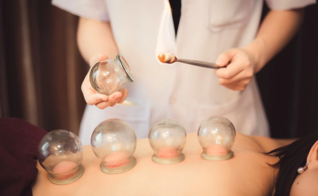 Cupping $20