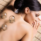 Cupping - $20/time