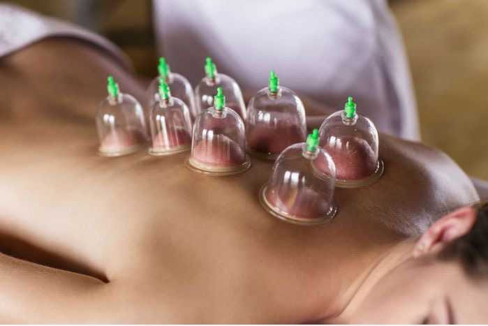 30Min Cupping