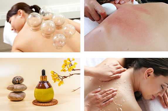30Min Cupping + Gua Sha