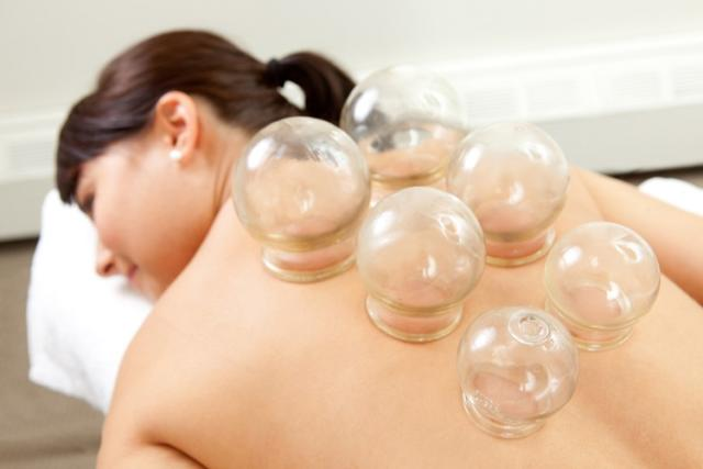 Add On - cupping  $20